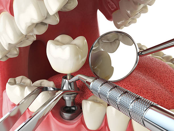 Best Emergency TMJ Treatment in Belvedere Park, GA